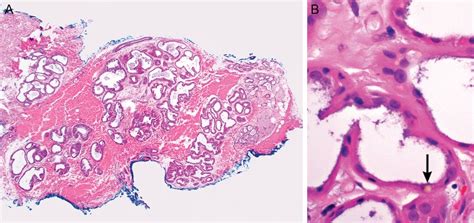 Ceruminous Glands Histology