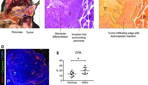 A, Gross image of pancreas (blue dotted line) and PDAC tumor (yellow... | Download Scientific ...