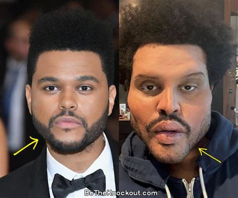 Did The Weeknd Have Plastic Surgery His New Look Explained | SexiezPix ...