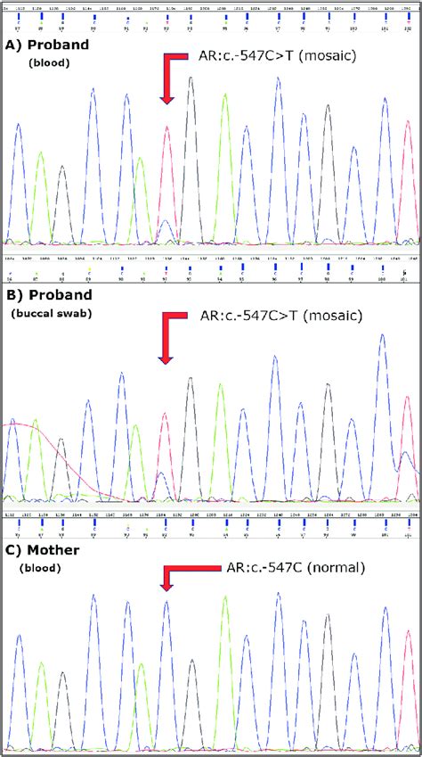 Electropherograms from Sanger sequencing for DNA isolated from: A)... | Download Scientific Diagram