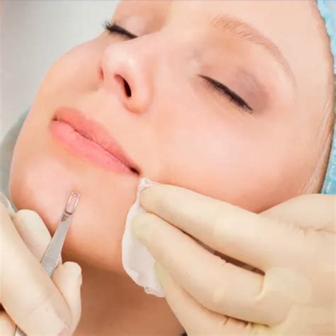 Pore Extraction – Signature Beauty Lounge