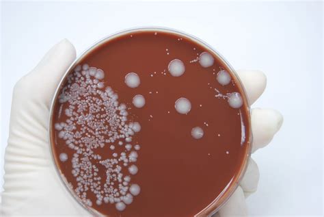 E. Coli Facts From A Disease Specialist | Piedmont Healthcare