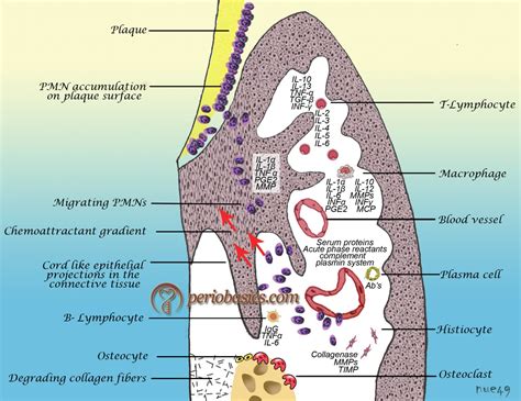 Periodontal pocket – periobasics.com