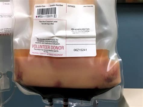 064CE: Granulocyte Transfusions with Ron Strauss - Blood Bank Guy