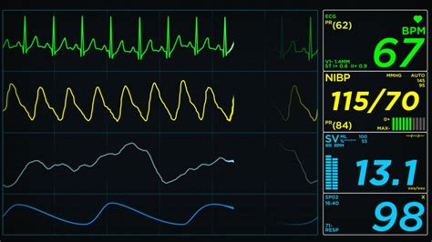 EKG Display Monitor - YouTube