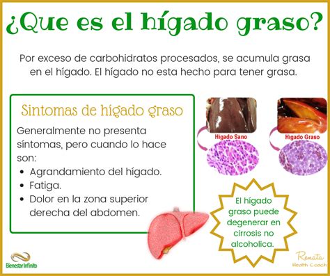 ¿Qué es el hígado graso? - Bienestar Infinito