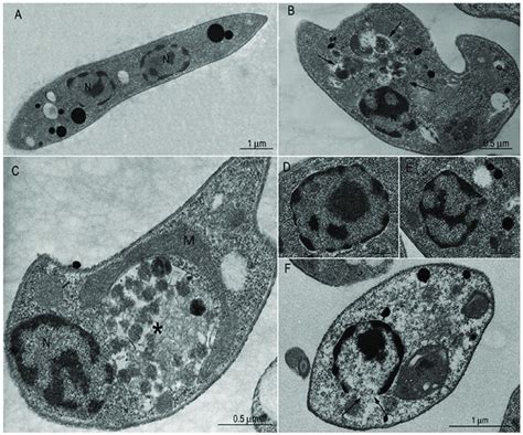 Transmission electron microscopy of Leishmania amazonensis ...