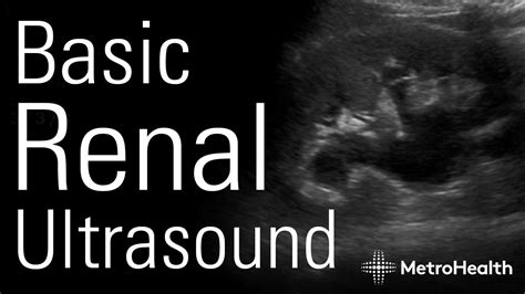 Basic Renal Ultrasound - YouTube