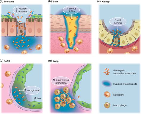 Anaerobic Bacterial Infections