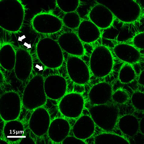 August 2020 Newsletter Fluorescent Membrane Probes MemGlow comparison