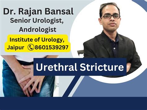 Urethral Stricture: Causes, Symptoms, Diagnosis, and Treatment