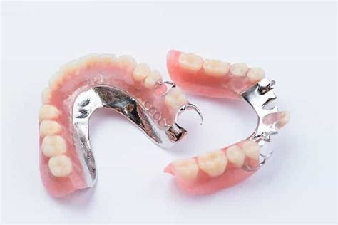 Types and Cost of Partial Dentures | District Dentistry Charlotte