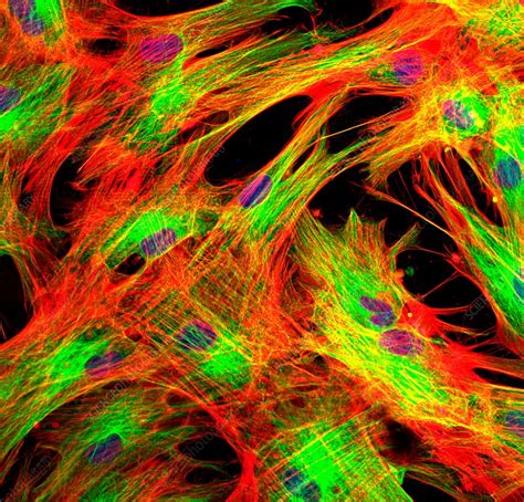 Fibroblast skin cells, fluorescence light micrograph - Stock Image - C034/5106 - Science Photo ...