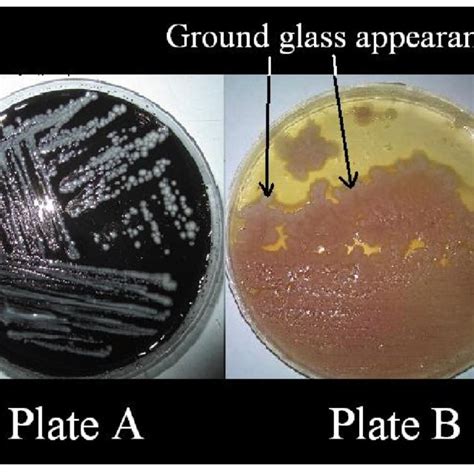 Figure1. Culture plate showing the Legionella pneumophila growth on the... | Download Scientific ...