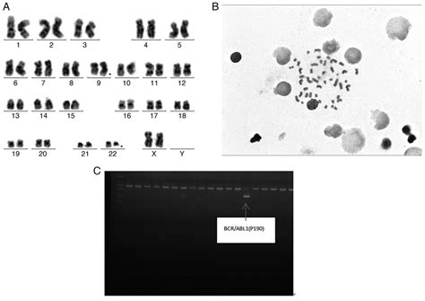 Chromosome and PCR results. (A and B) Chromosome images and (C) fusion... | Download Scientific ...