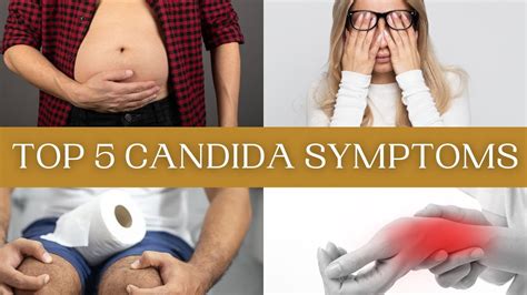 Candida Symptoms