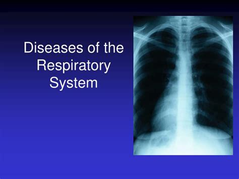 PPT - Diseases of the Respiratory System PowerPoint Presentation, free download - ID:1172015