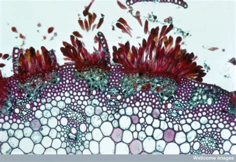 B0004474 TTS wheat rust uredosori, light microscope - Jon Lieff, MD