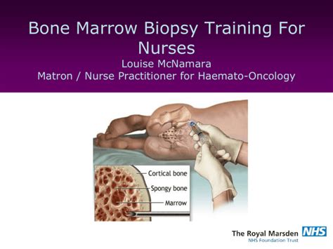 Bone marrow biopsy training for nurses