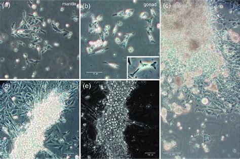 Adherent cells. (a) Phase contrast image of adherent cells in mantle ...