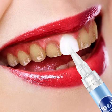 Teeth Care Gel Bleach Dental Stain Remover Brighten Whitening Pen Oral Care Tool -in Teeth ...