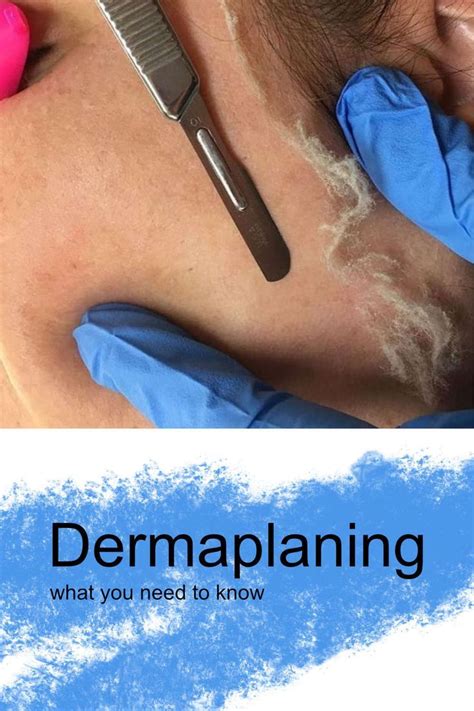 Dermaplaning - Everything You Need To Know | Dermaplaning, Popular skin ...