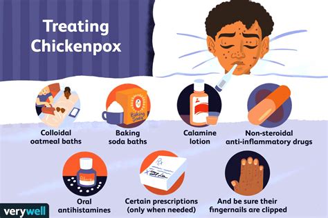 Treatment Of Chickenpox