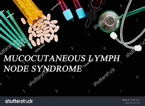 Mucocutaneous Lymph Node Syndrome Text On Stock Photo 2238676271 | Shutterstock