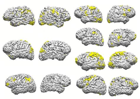 fMRI results. 3D BOLD activation brain images of 7 subjects in ...