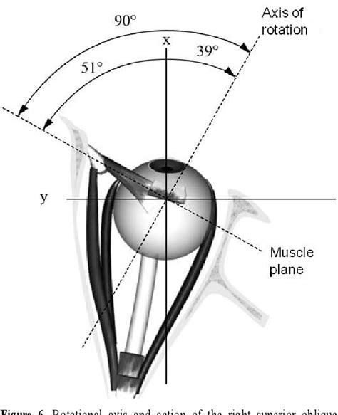 Figure 1 from Pathophysiology of Nystagmus in Benign Paroxysmal Positional Vertigo | Semantic ...