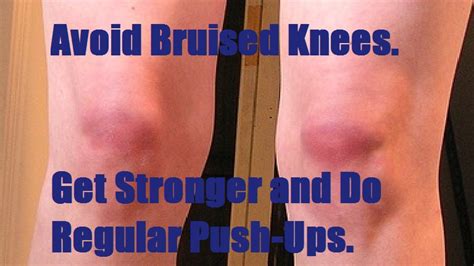 Body by Wii: Bruised Knees