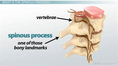 Spinous Process | Definition, Function & Fracture Treatment - Lesson ...