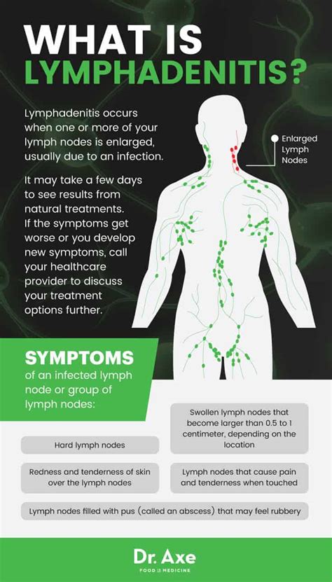 Lymphadenitis: 9 Natural Antibiotic & Antiviral Treatments - Dr. Axe