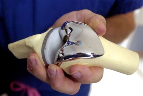 WATCH: A Total Knee Replacement Surgery Procedure | Gizmocrazed - Future Technology News