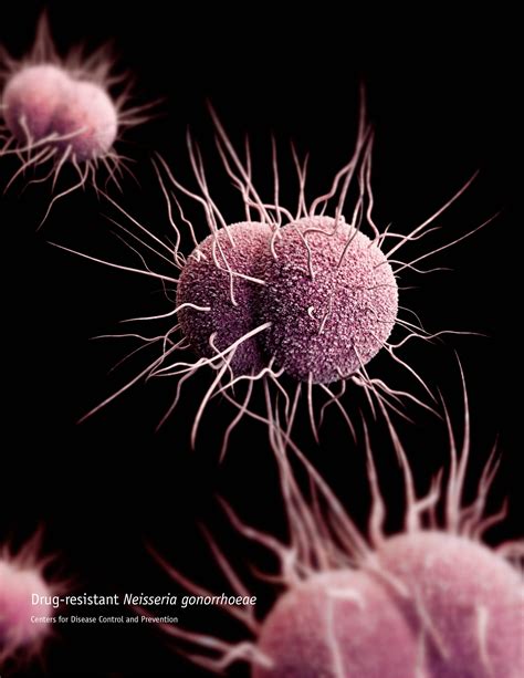 Gonorrhea may soon become resistant to all antibiotics