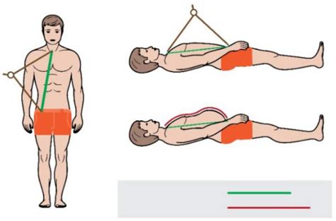 Measurement of a distance between the sternal notch and the femoral... | Download Scientific Diagram