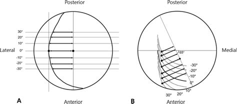 A and B Schematic composite showing changes of A lateral center-edge... | Download Scientific ...