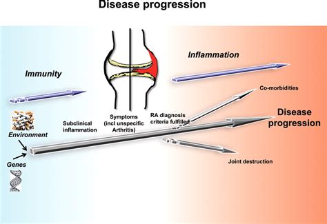 Prevention of autoimmune rheumatic disease: state of the art and future perspectives | Annals of ...