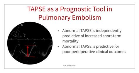 TAPSE as a Prognostic Tool in Pulmonary Embolism Cardioserv