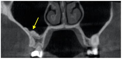 Diagnostics | Free Full-Text | The Use of CBCT in Evaluating the Health and Pathology of the ...