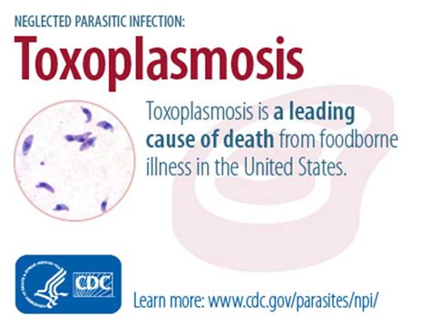 CDC - Toxoplasmosis