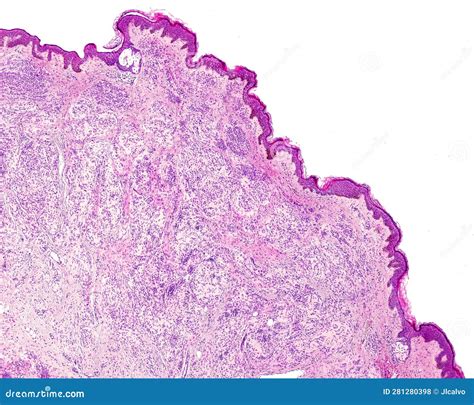 Melanocytes Histology