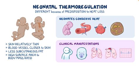 Thermoregulation - Neonate: Nursing - Osmosis Video Library