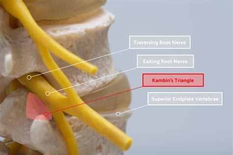 Oblique Lateral Interbody Fusion (OLIF) Surgery: Approach and Critical Lighting Required