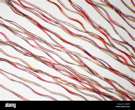 Fiber microscope hi-res stock photography and images - Alamy