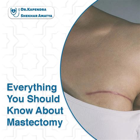 Everything You Should Know About Mastectomy: