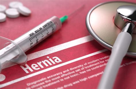 Hernia Mesh Complications, Failure and Recall Lawsuit Investigation