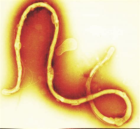 Lyme Disease: Borrelia burgdorferi & the Mouth - Toothbody