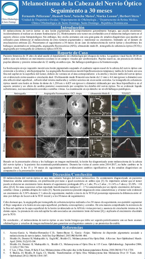 (PDF) Optic Nerve Head Melanocytoma: 30 Months Follow Up.