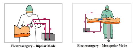 cut vs coagulation cautery Archives - Electrical Safety Testing Laboratory